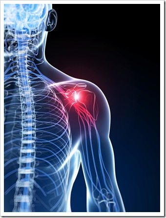 Shoulder Pain Miami FL Rotator Cuff Syndrome