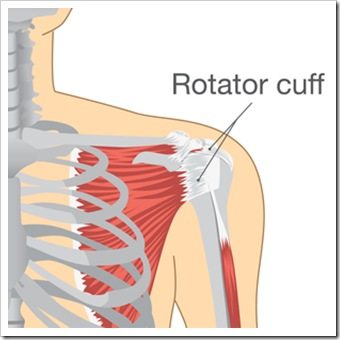 Shoulder Pain Miami FL Rotator Cuff Injury